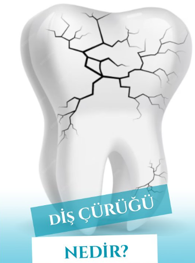 Instagram Reels Görseli