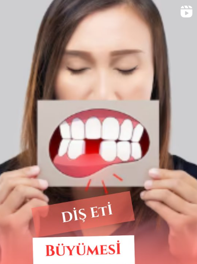 Instagram Reels Görseli