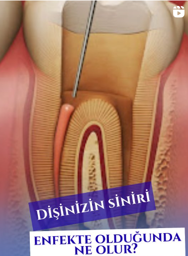 Instagram Reels Görseli