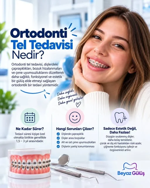 Ortodonti: tel tedavisi nedir?