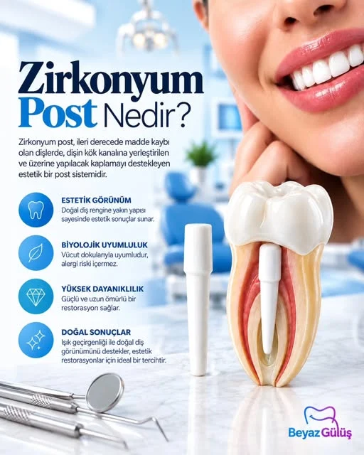 Zirkonyum post nedir?