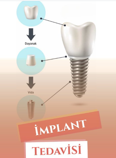 Instagram Reels Görseli