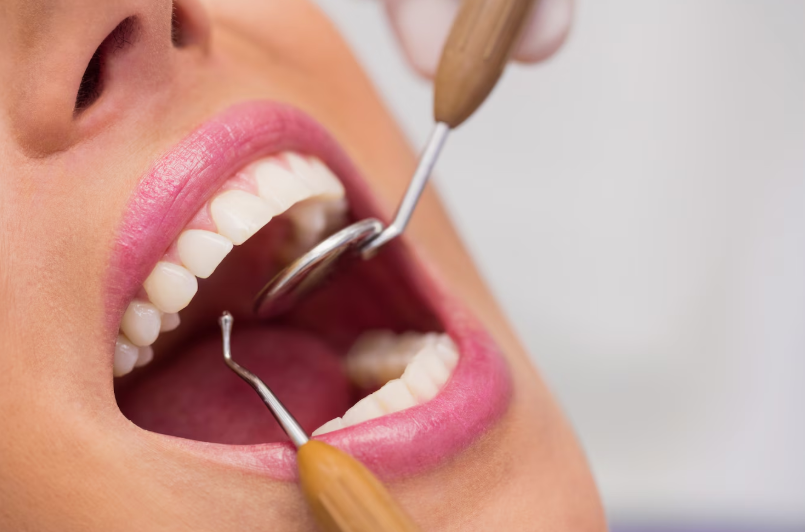 Periodontoloji