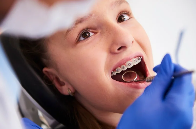 Acarkent 
Ortodonti Tedavisi
